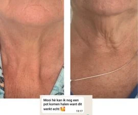 KRX Neck Lift Intensive Firming Neck Cream - Foto 5