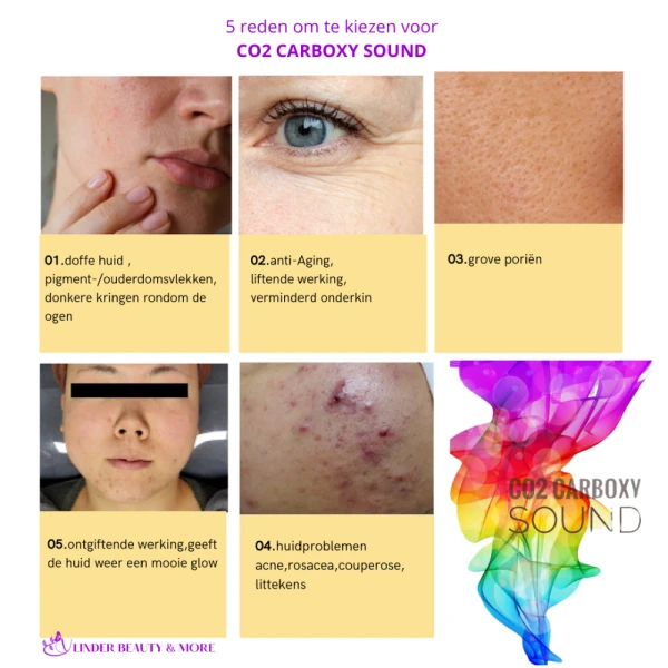 Ribeskin Carboxy CO2 skincare  thuis kuurbehandeling - Foto 5